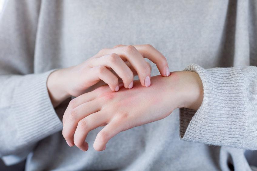 Ragadi alle mani: cause, sintomi e cura
